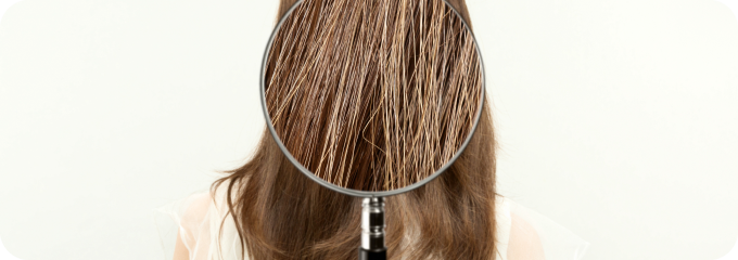 Nutricionista - Análisis de Cabello